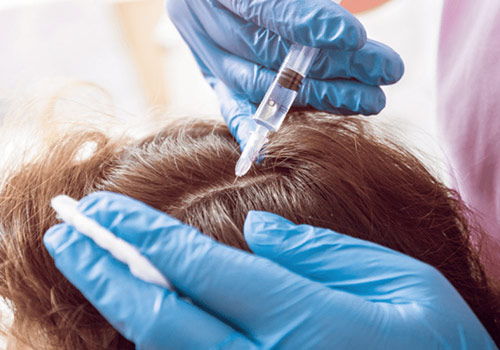 PRP for Hairloss Qatar | PRP Treatment in Doha
